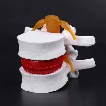 Модель поясничного отдела позвоночника из ПВХ, реалистичные 3D Учебные инструменты, учебные пособия по костям позвоночника, Анатомический инструмент для помощи